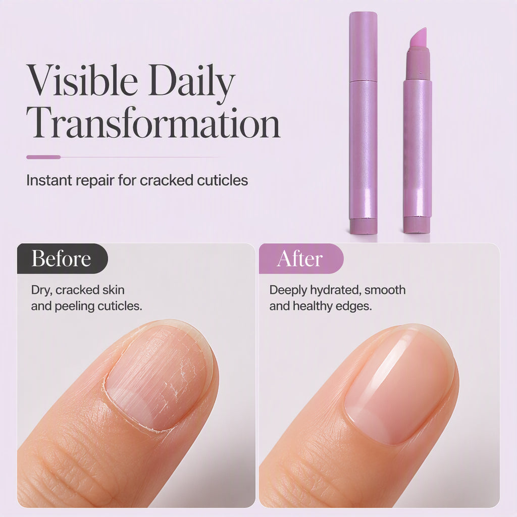 ✨BUY 1 GET 1 FREE!🌟✨Portable Nail Care Essence Pen